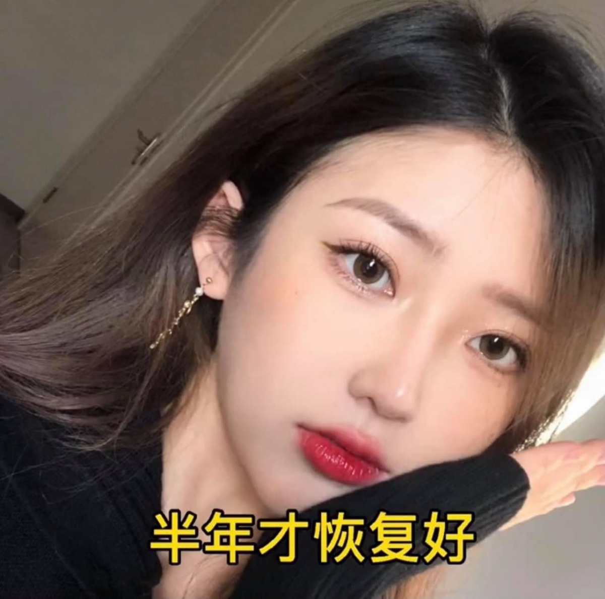 而后Po主晒出已恢复好的自拍照,时下流行的小扇形双眼皮、隆鼻效果都颇为自然,经过为期半年的修复后,全脸已经近乎没有留下任何「修修脸」痕迹。