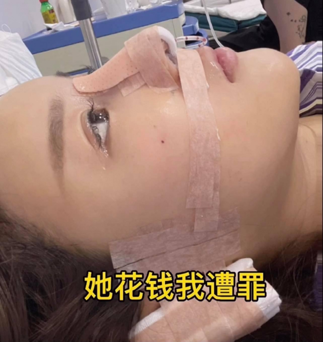 图文中爆笑“亏”闺蜜应该是嫌弃自己不够漂亮才砸巨资赞助整容项目(笑)还贴出术后在病床上的照片戏称:「她(闺蜜)花钱,我遭罪!」