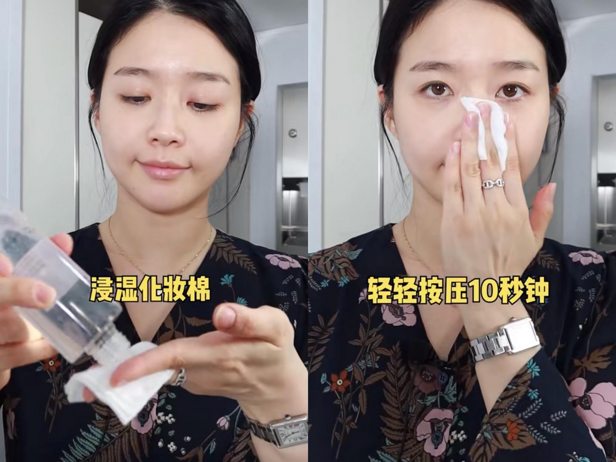 步骤（三）来到最后步骤，用清水彻底将脸洗干净。然后进入日常护肤程序，建议使用含有茶树、积雪草等镇静舒缓成分的化妆水，浸湿化妆棉后轻轻按压刚刚完成清洁的鼻头肌肤，这个动作可以带走皮肤表层残留的废弃皮质，同时可以达到镇静和收敛毛孔效果。记得不要用化妆棉来回摩擦肌肤，避免导致屏障受损。