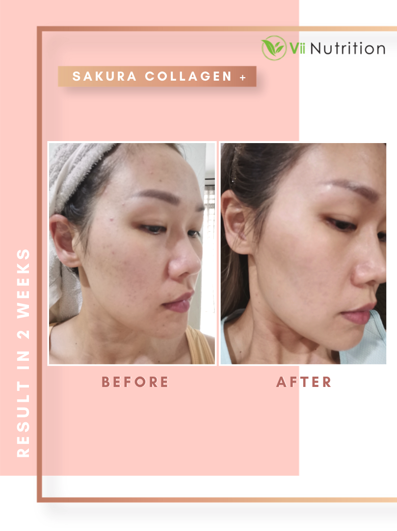 Vii Nutrition 推出的 Sakura Collagen+ 配方经过临床试验证明: 使用4星期有效改善皱纹,肌肤弹性明显提升; 使用4星期肌肤滋润度和锁水力提升;
