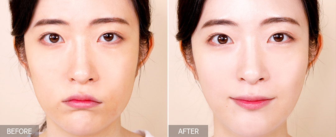 TIA’M Vita B3 Source精华中汇聚了相辅相成的这2大成分,能有效改善暗斑、肤色不均问题,同时烟酰胺还有抑制多余油脂分泌、抗皱和对抗痘痘效果,形容它是「双重亮白美肌好物」真的一点都不为过!