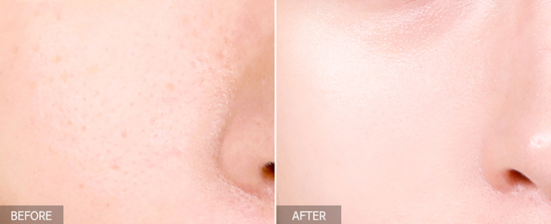 TIA’M Vita B3 Source精华中汇聚了相辅相成的这2大成分,能有效改善暗斑、肤色不均问题,同时烟酰胺还有抑制多余油脂分泌、抗皱和对抗痘痘效果,形容它是「双重亮白美肌好物」真的一点都不为过!