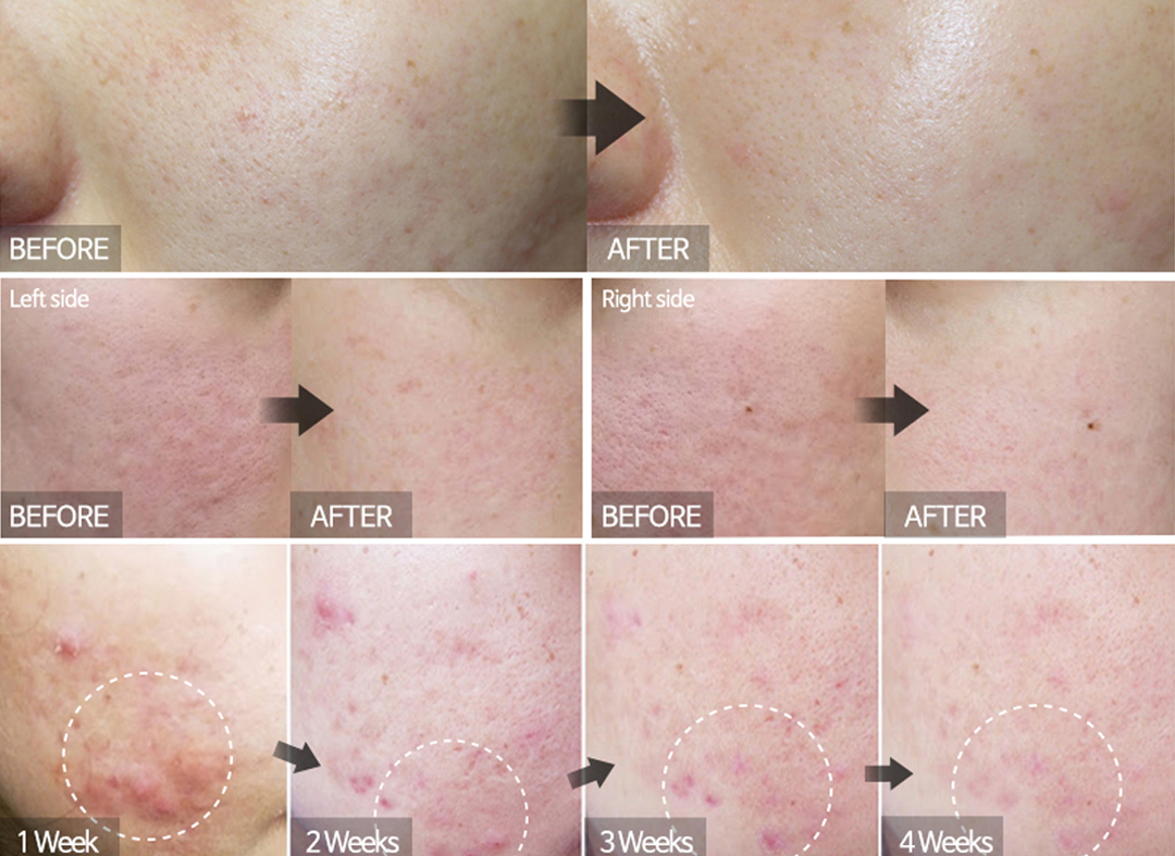 在使用C Source精华后轻抹一层A+ Cream,可以瞬间将渗透进皮肤的精华滋养牢牢锁在肌底,同时强化肌肤对维生素C成分的吸收效果,使美肌功效像开了Turbo一般、实现焕亮美白+保湿补水效果最大化 ❤