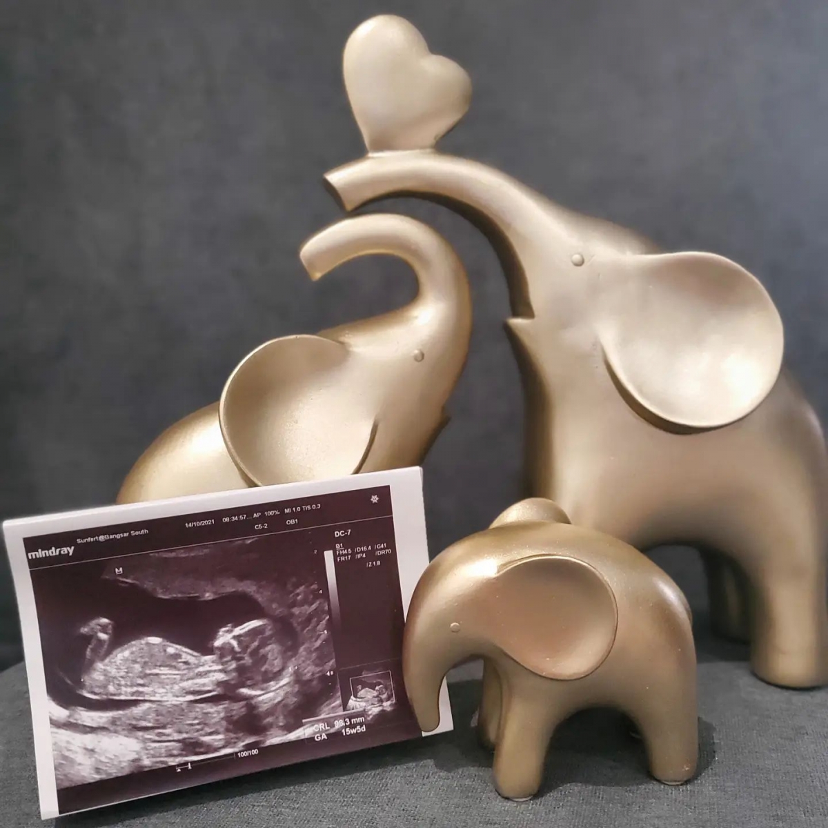 结婚多年,不少人都非常关注「萧慧敏」的肚皮动静~直到刚才「萧慧敏」突抛震撼弹宣布「怀孕」喜讯,让圈内朋友喜欣若狂纷纷送上祝福。