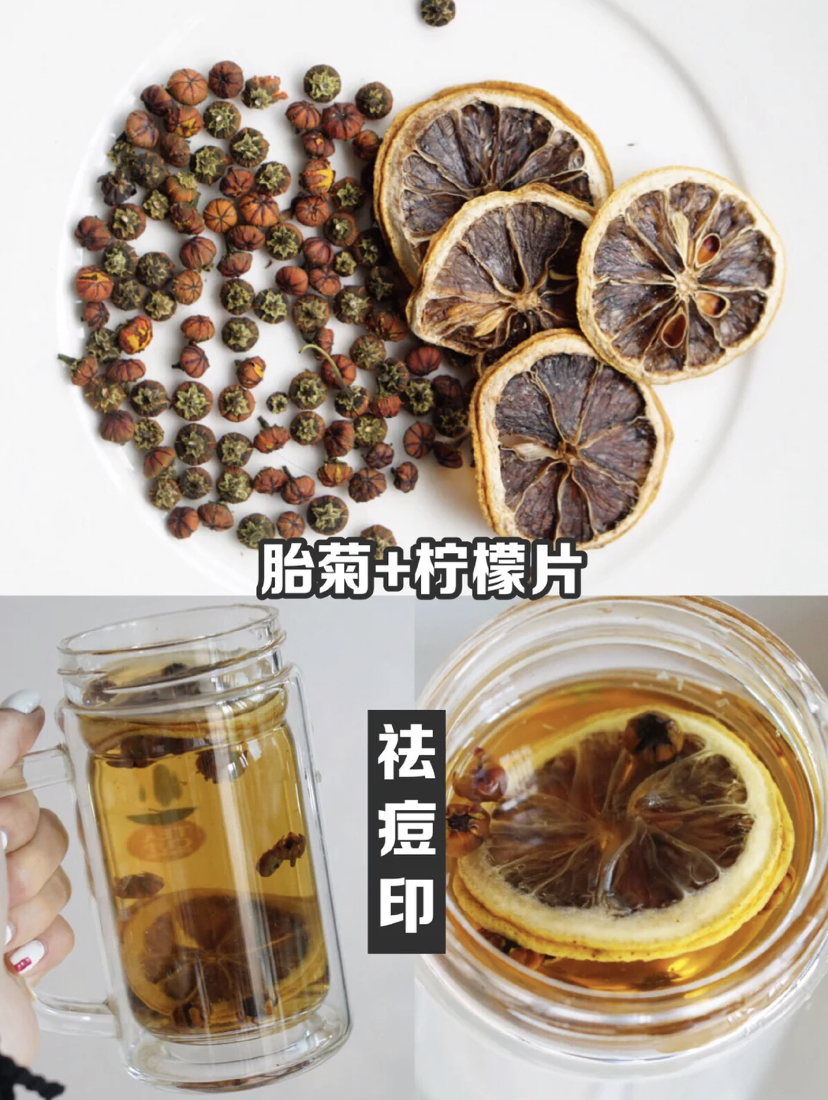 祛痘印养生茶