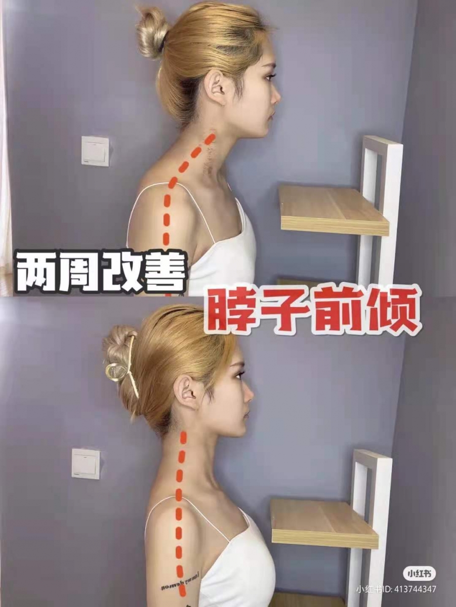 1018_ Neck forward(1)