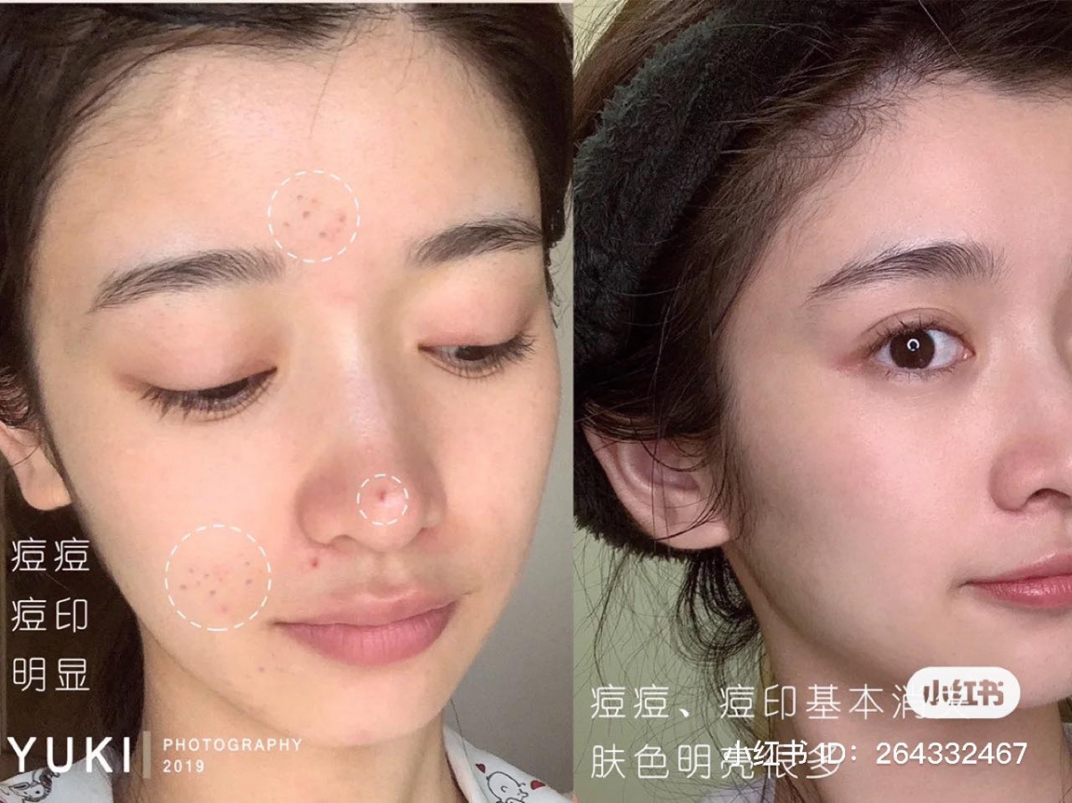 Melano CC乐敦美白精华使用方法(一):使用前必须用化妆水/爽肤水给肌肤打好底,待水被皮肤彻底吸收后,这使皮肤具备了更好的水溶性吸收环境,美白精华成分更易渗透发挥功效