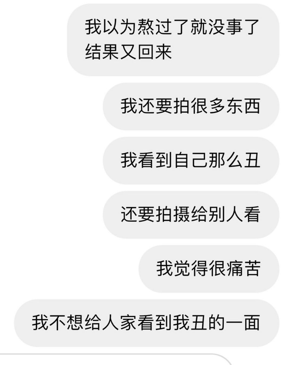 我本身不是天生丽质的女孩子,我有发过我小时候的照片,丑丑的~所以在变美这条路上我花了很多功夫」。