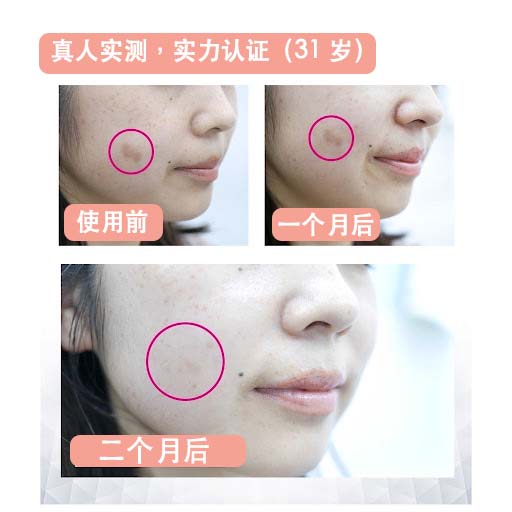 Mskin the White C 美白精华 稳居功能性护肤品冠军,3个月明显看到神奇变化