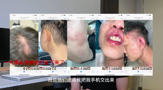 结果 YBB 带她到一个地方却找人殴打她还抢了他的手机。幸好是 Chris 早已把手机里的证据转移到其他地方。