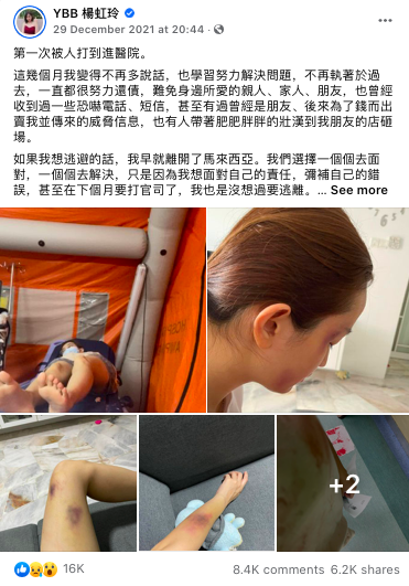杨宝贝 YBB 自从卷入欠债风波,也在积极工作一点一点还清。近期,YBB 遭遇恶男殴打事件瞬间引起热议