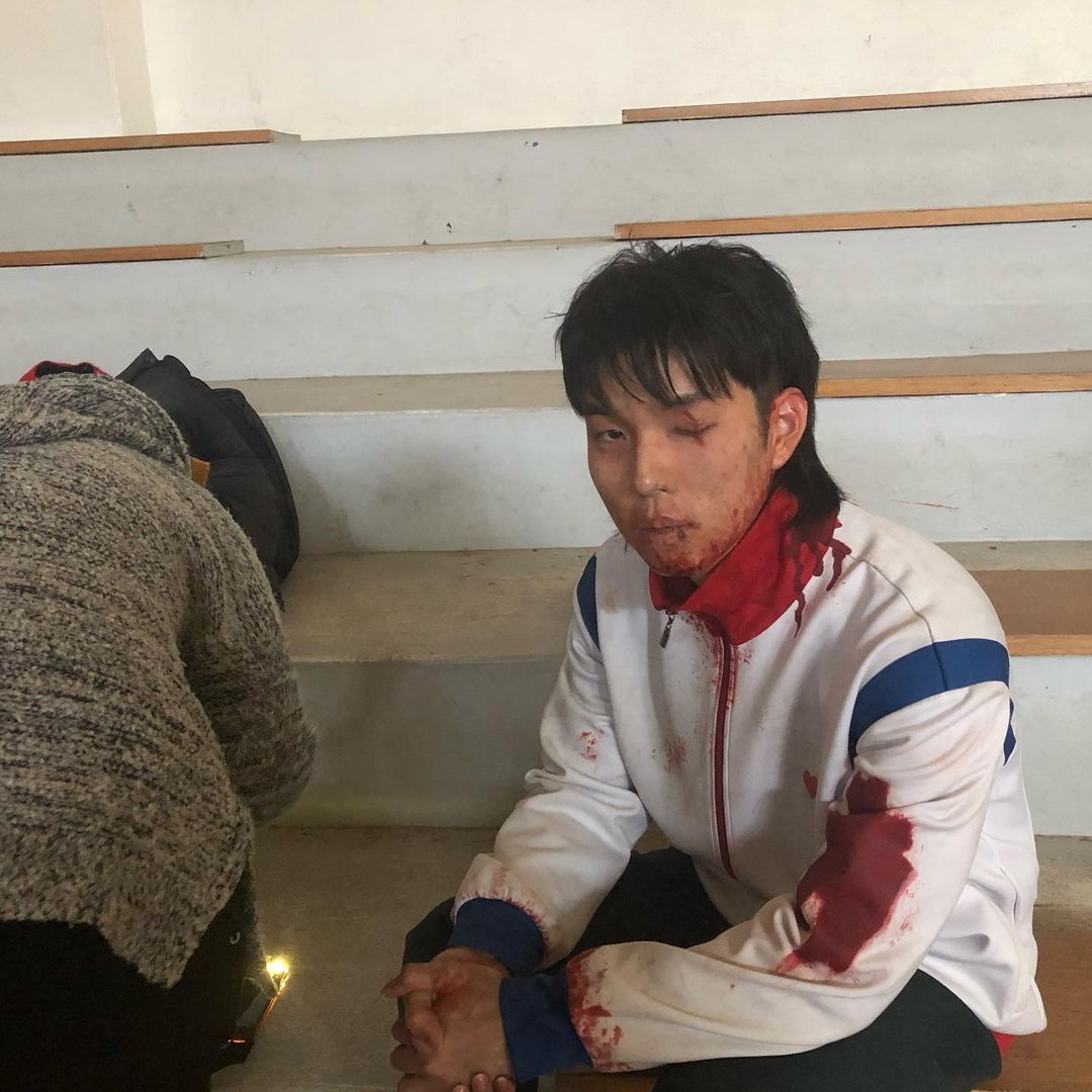 由于后半部登场,我的嘴边几乎都要有血液~那个血是糖浆甜甜的,吃太多糖浆胖很多,大概胖了 10 KG~拍《僵尸校园》喝太多血了