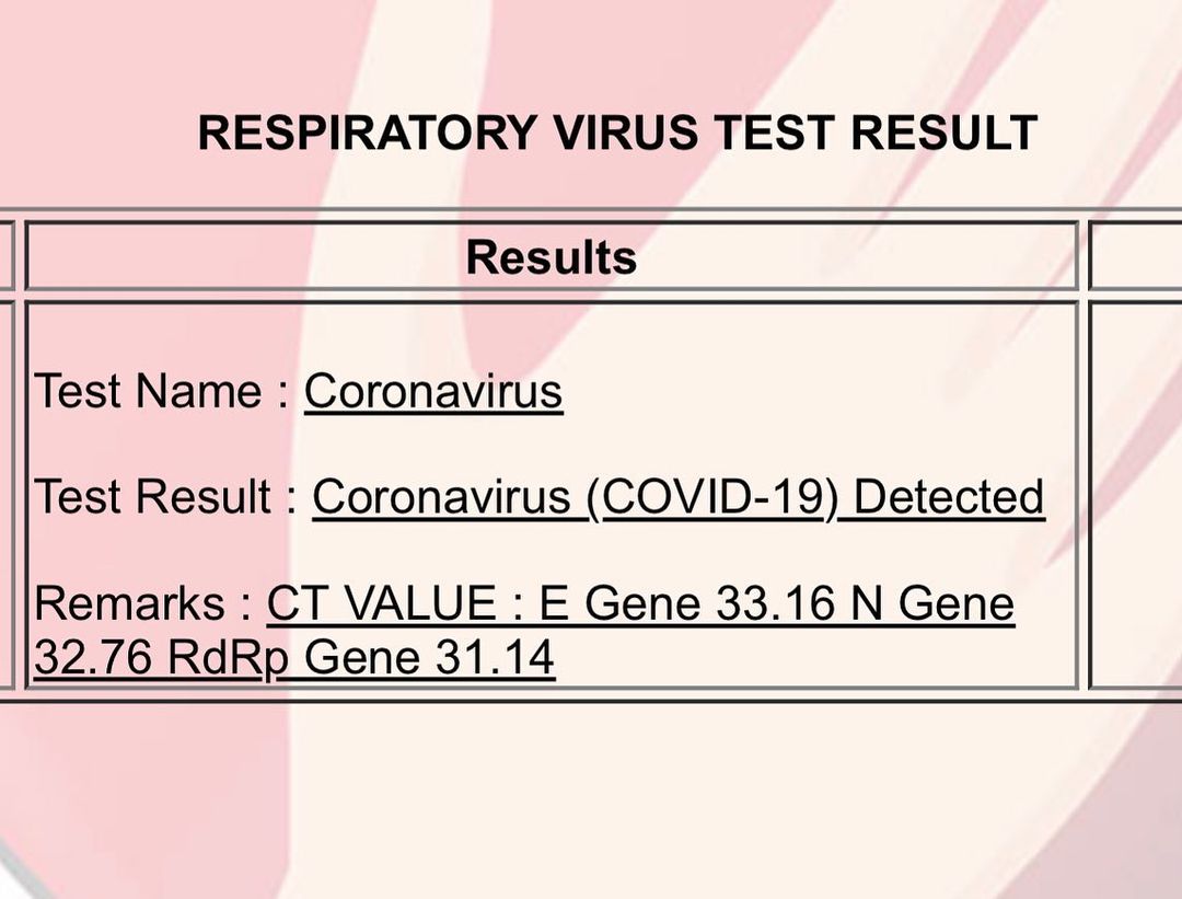没想到几个小时后，他就PO出了PCR检测报告，显示他受感染了。