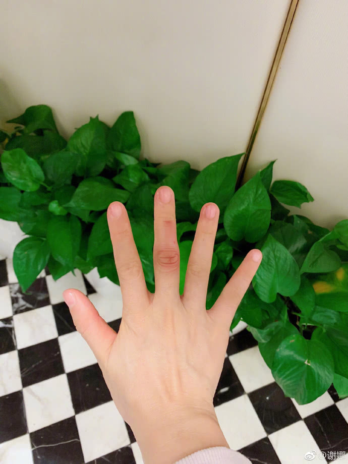 刚好那个车门一关就不小心夹了一下她的手指。