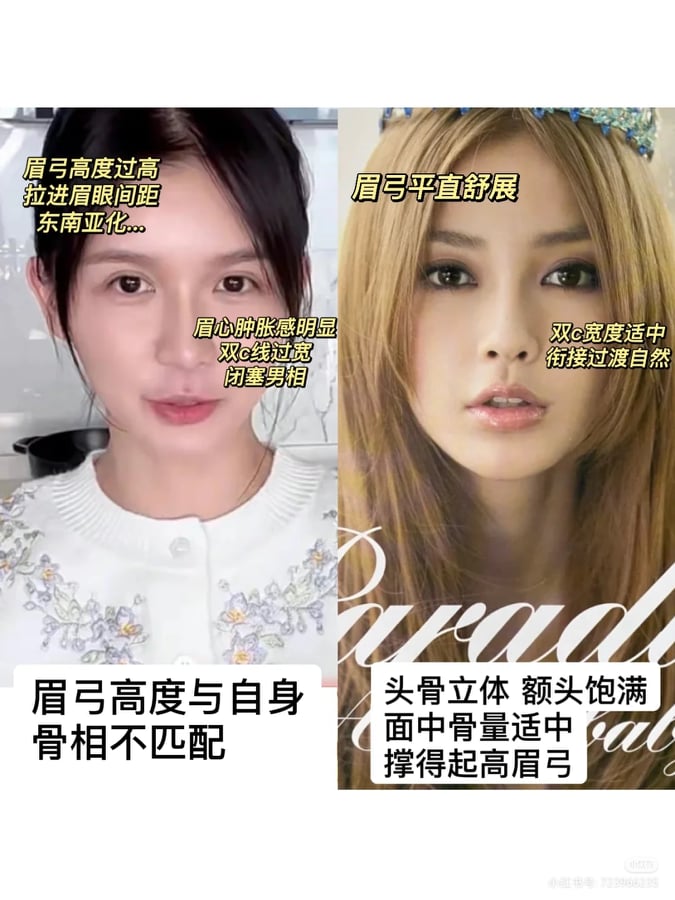 认为她不顾个人风格,盲目加高眉心眉骨「也许只会加重男相,东南亚感满满…」。