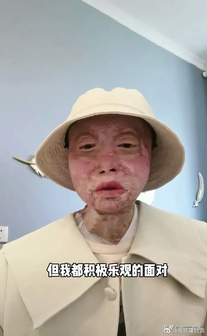 面包车被大火吞没,乔燕使出全力打开车门却打不开,被浓烟呛到的乔燕渐渐也失去意识...