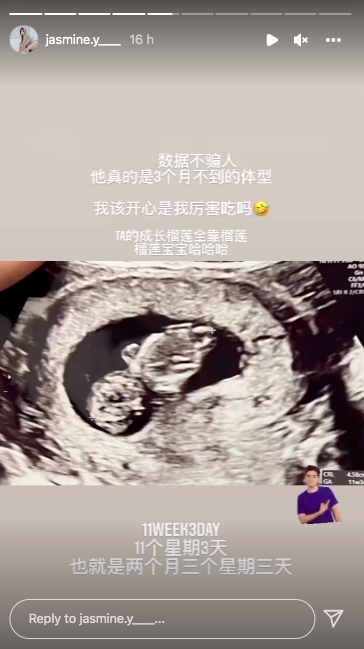 此外,香米还大方晒出宝宝的超音波照片,力证腹中的宝宝只有11个星期3天(2个月3个星期3天)