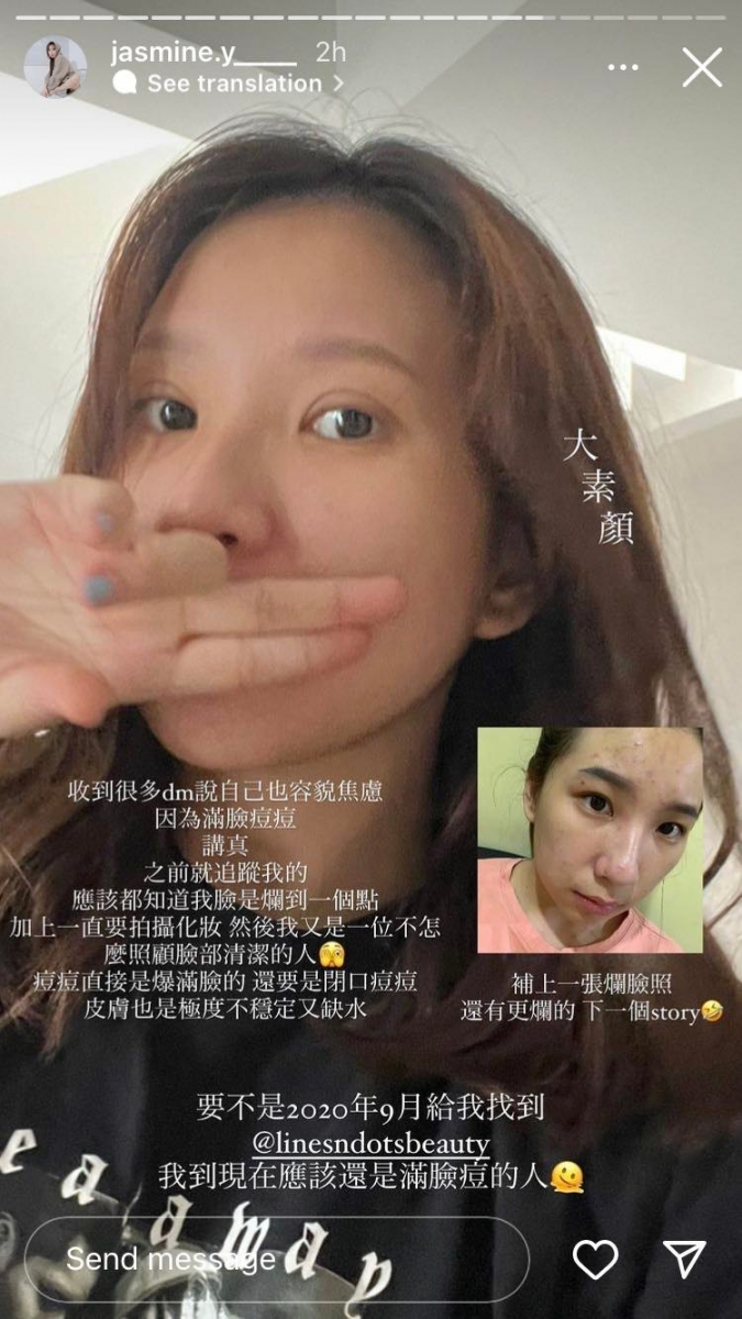 容貌焦虑越来越普遍化