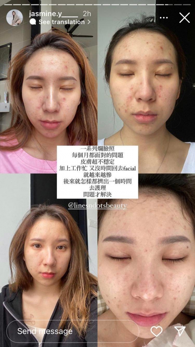 鼓励女孩们走出容貌焦虑