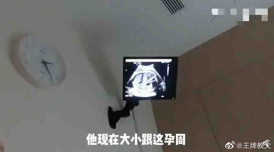 影片中苗苗不忘透露孩子经常踢她，这足以表示第二胎其实早就怀上了