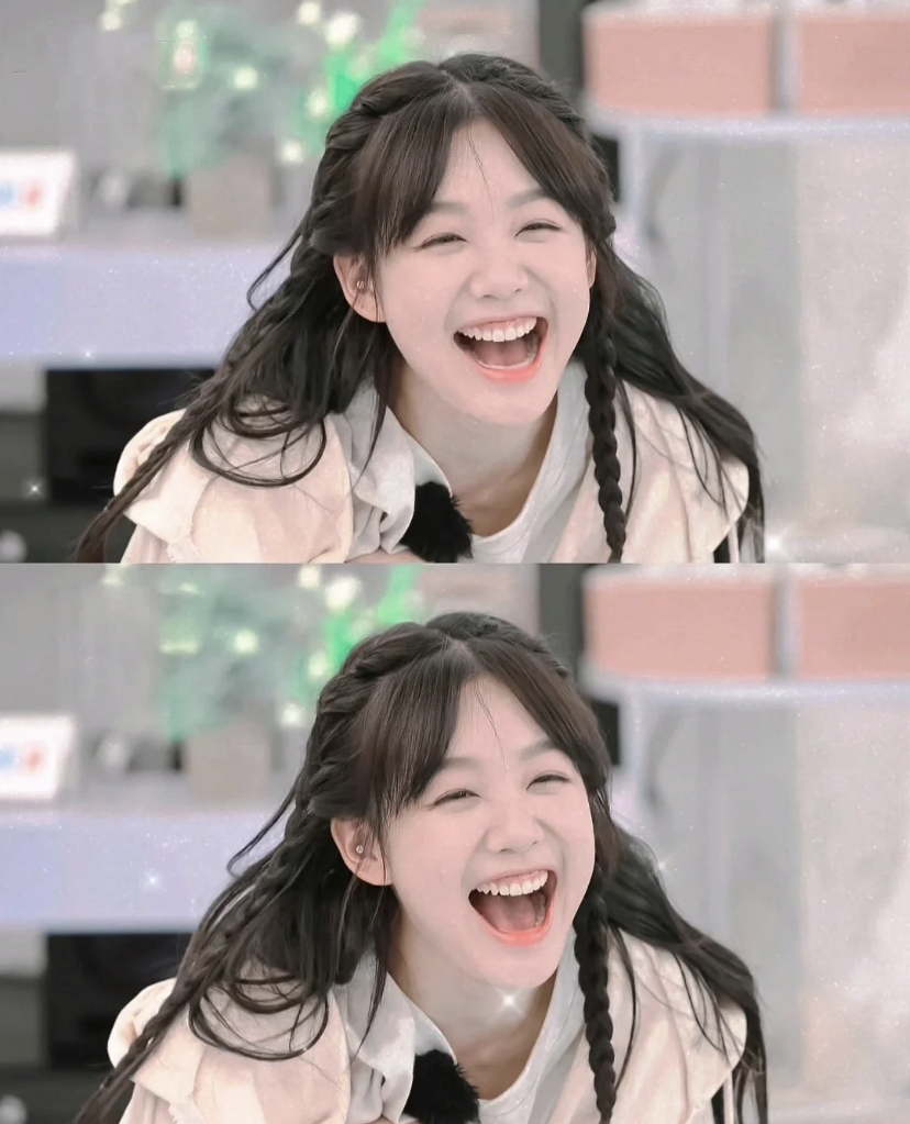 笑起来时嘴巴张幅蕞大的,会拉开嘴角同时向下延伸了下巴,可以改善嘴凸和下巴后缩的问题。