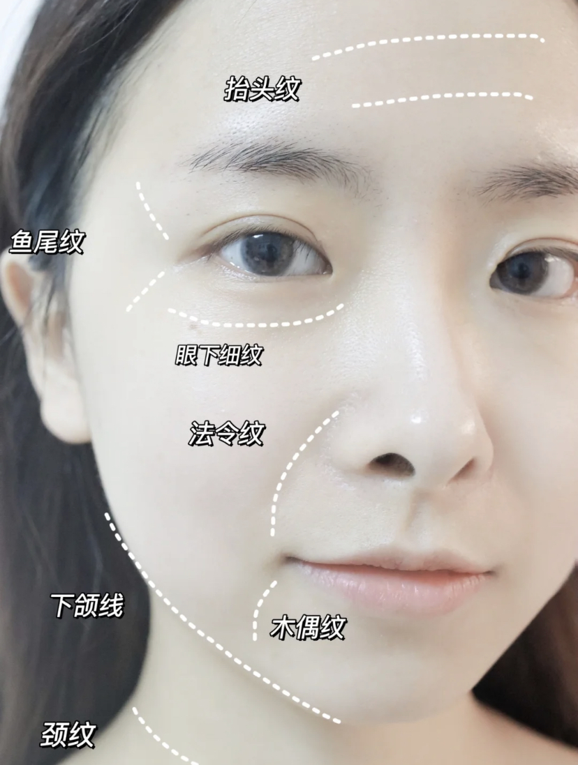 肌肤因为衰老会变薄导致出现色斑,还有小细纹、干纹都是轻度衰老现象。