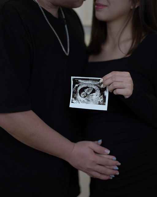 有网友还化身“柯南”认为从超声波的照片来看「baby看起来那么大了 应该3/4个月了吧?」