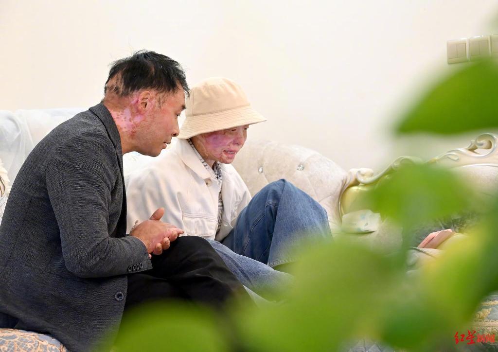 为了不让身边的至亲和他一样陷入痛苦的深渊,于是也决定积极乐观面对余生的挑战