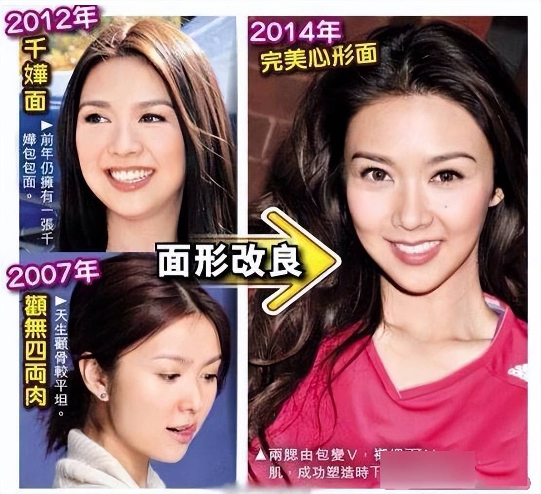 但其实早在2007年她就曾被港媒传出整容的消息,被吐槽从娃娃脸变成了网红脸,甚至还曾撞脸过杨千嬅。