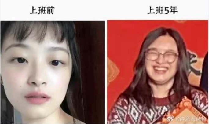 也有不少网友表示,自己入职后不仅颜值下跌,就连头发都开始变得稀疏。