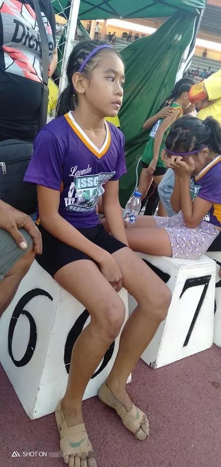 蕾雅用医用绷带缠脚为自己做出来一双专属于自己的“运动鞋”。