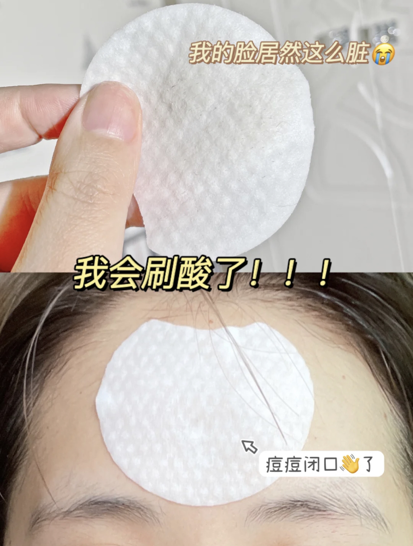 日常用平滑面湿敷告别闭口粉刺,纹理棉可以去除脸上的废旧角质。