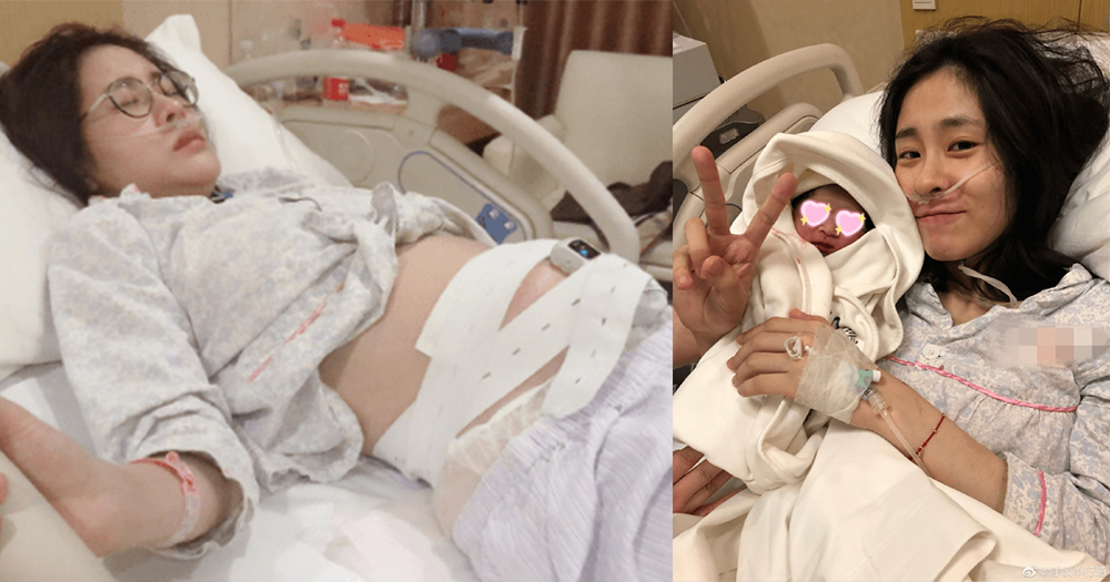 还晒出了张碧晨生产之际的照片，破除找代孕的谣言！