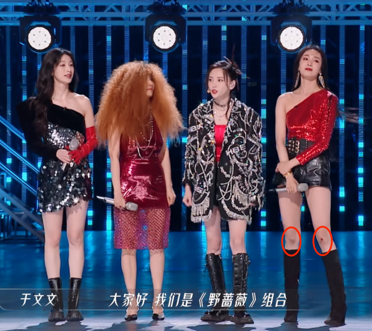 她的双膝很明显有磕伤的痕迹，左腿更是一小块红色血迹。