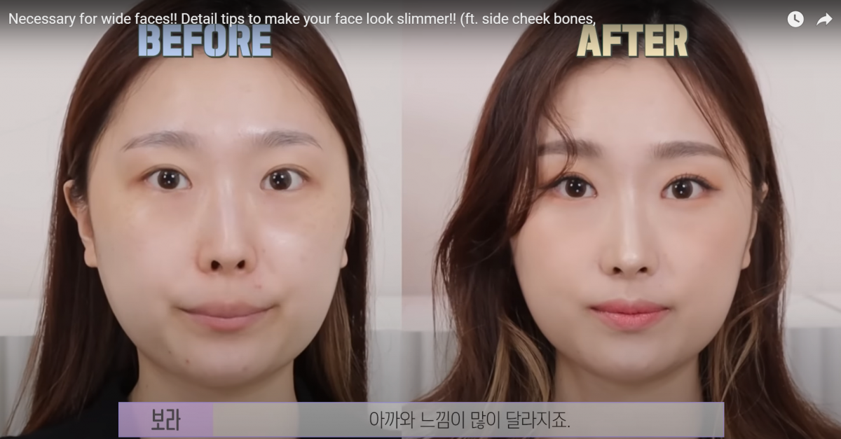 Before and After:现在整张脸是不是看起来小巧精致了不少呢?