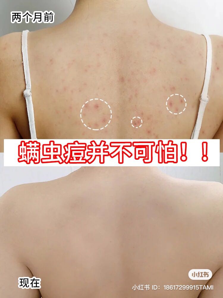 搭配温和抗痘成分沐浴乳