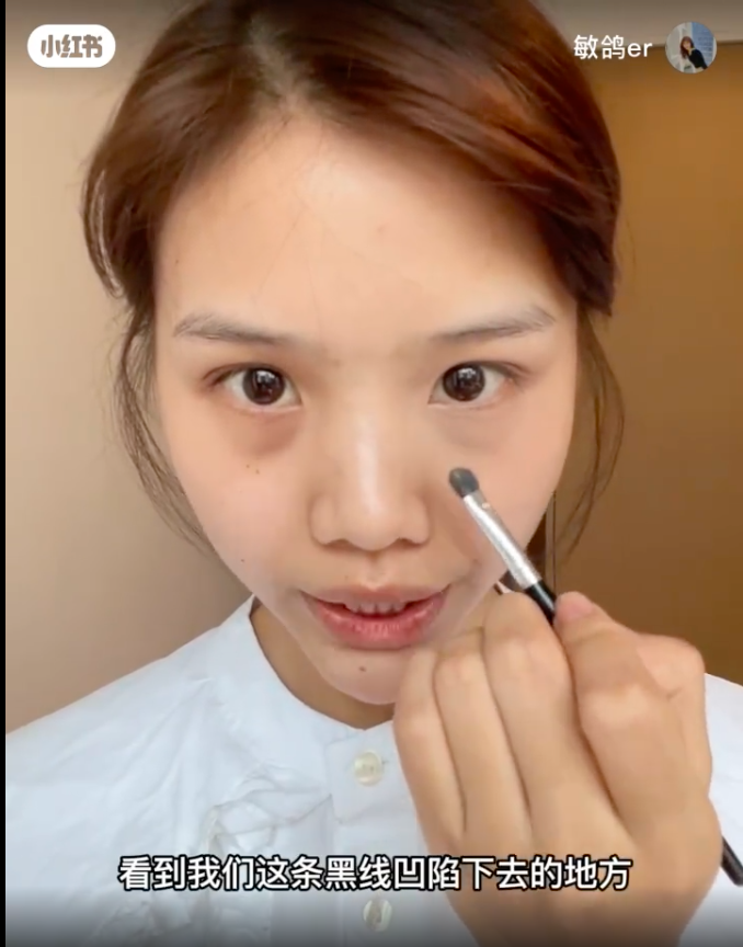 先低头找出泪沟的位置（黑线凹陷下去的地方）