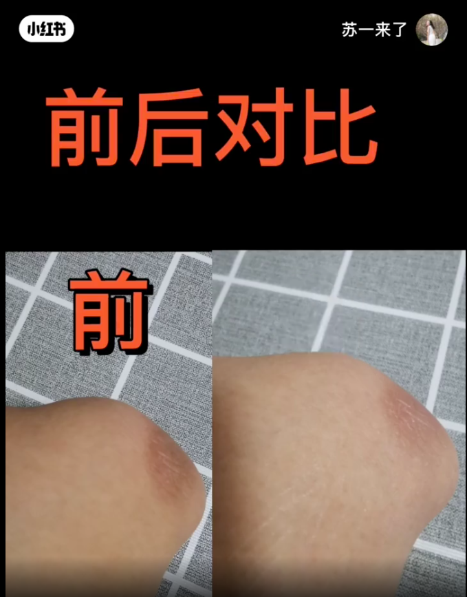 对比之前可说是白了不少~