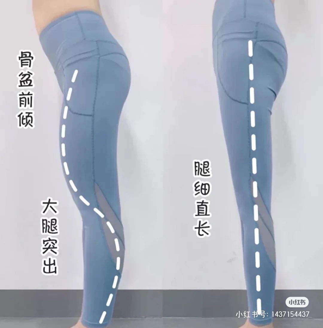 「膝超伸」会影响一个人的体态,还会让人视觉上变矮