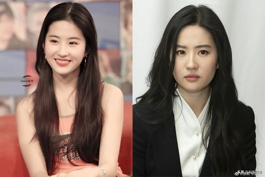 不同类型的发腮有不同的特征及应对方式，今天来学习如何改善「脂肪型发腮」吧！