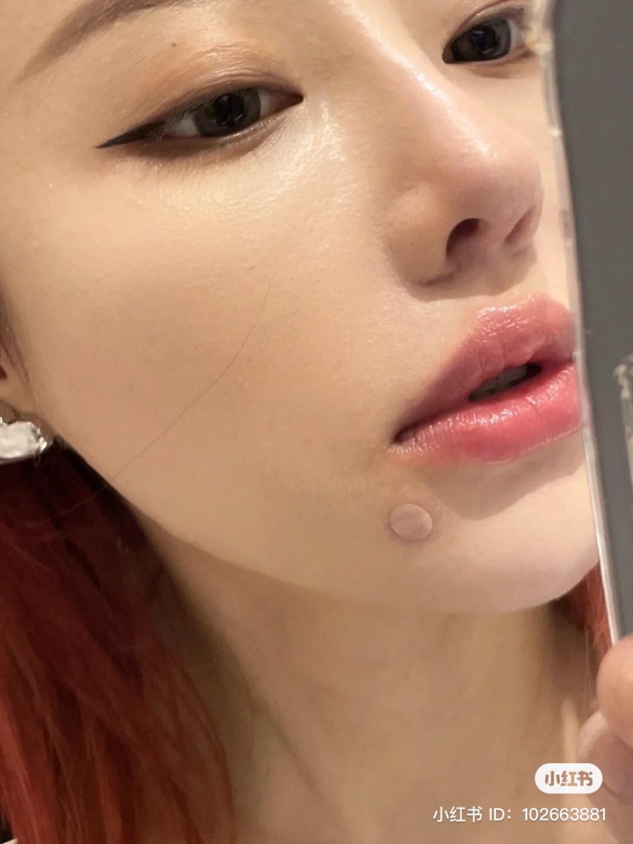 痘痘贴可以理解成脸部的「创可贴」