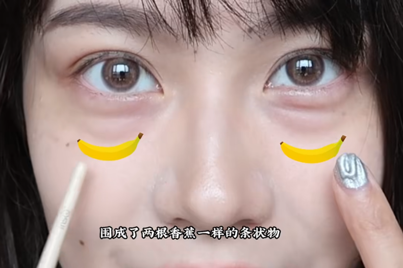 泪沟和黑眼圈的“判别”