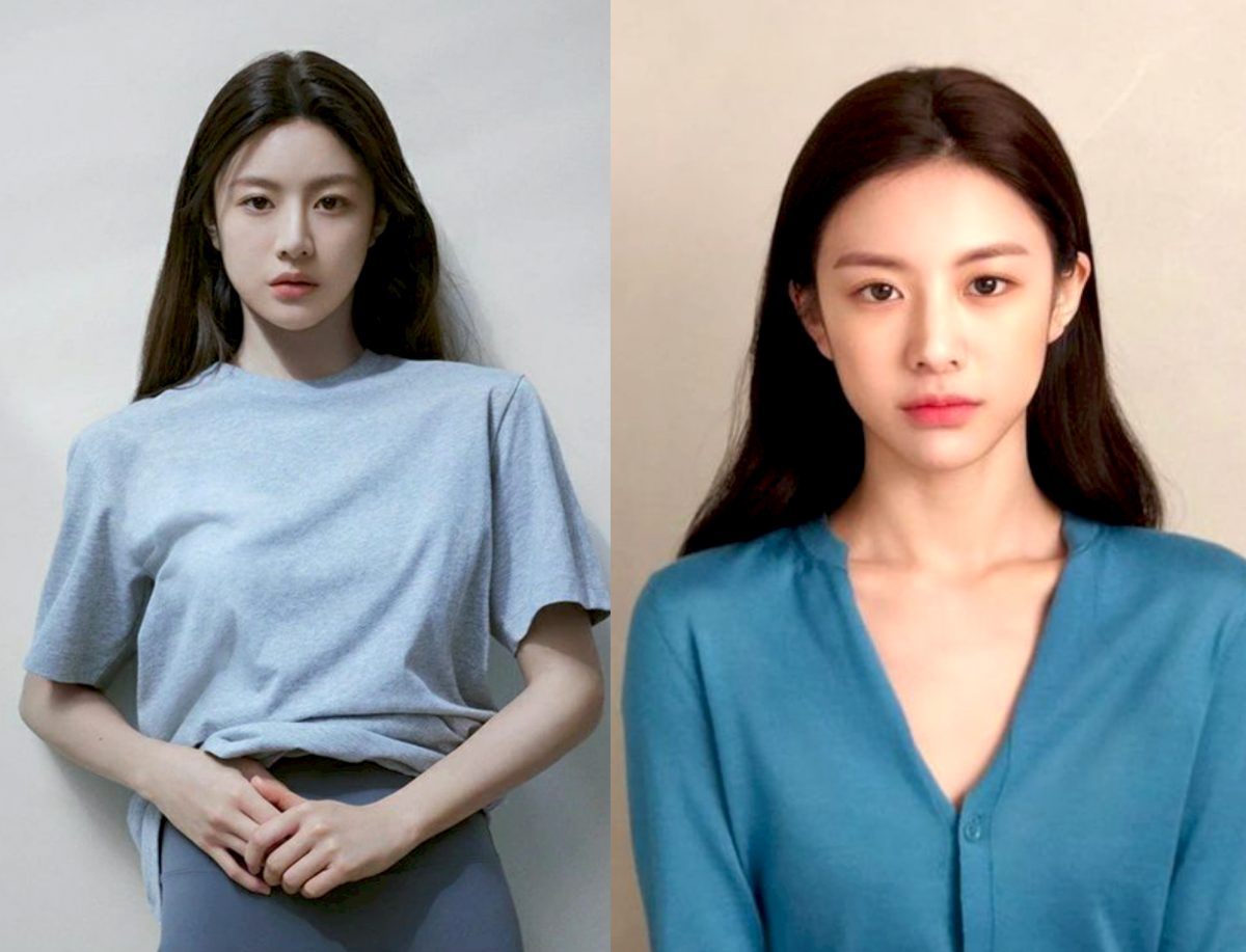 低颅顶让脸型在视觉上被放大