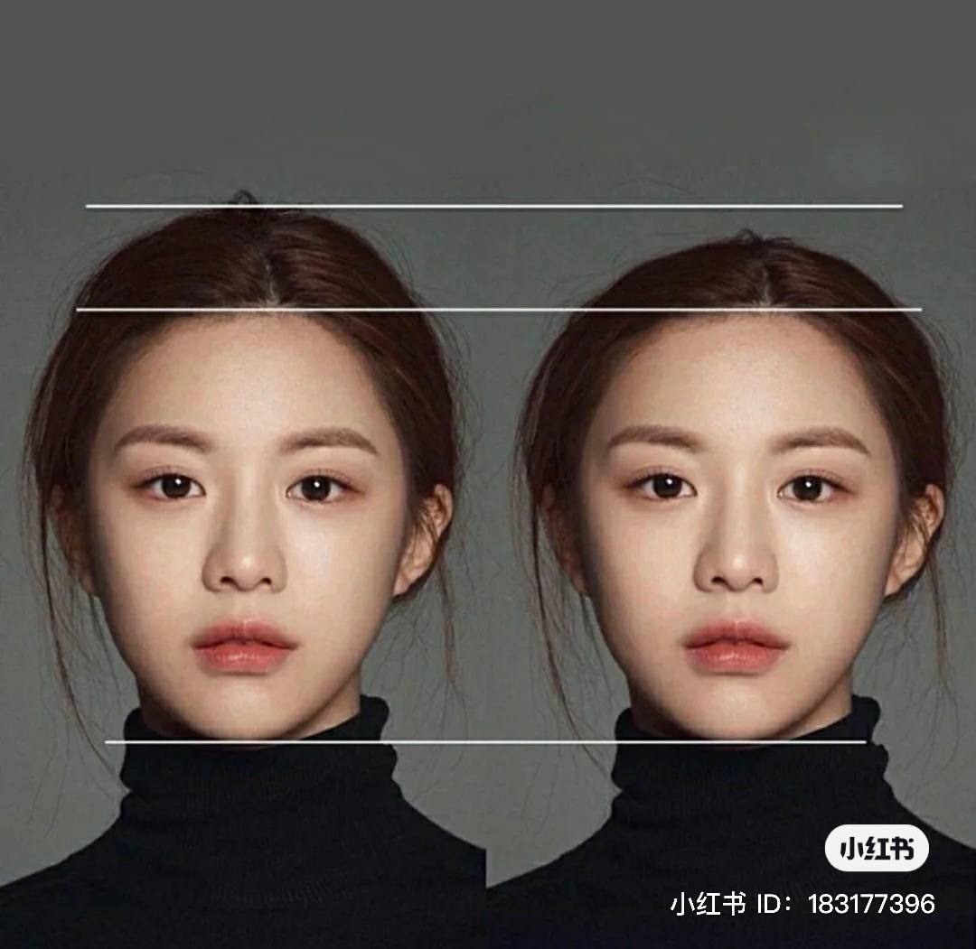 “颅顶“决定颜值