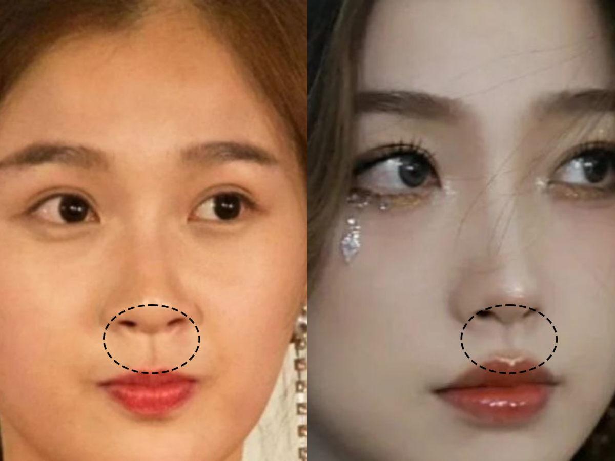 「人中」会很大地影响我们的视觉年龄哦~