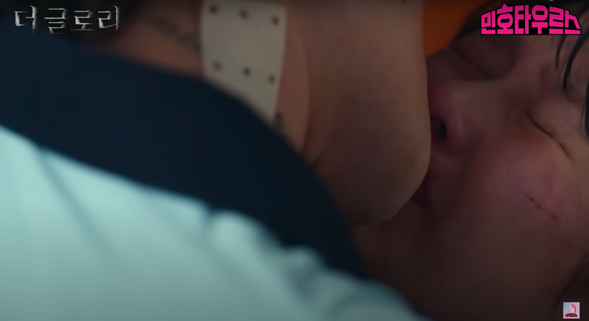 朴涎镇就决定要用电发棒烫伤文同珢