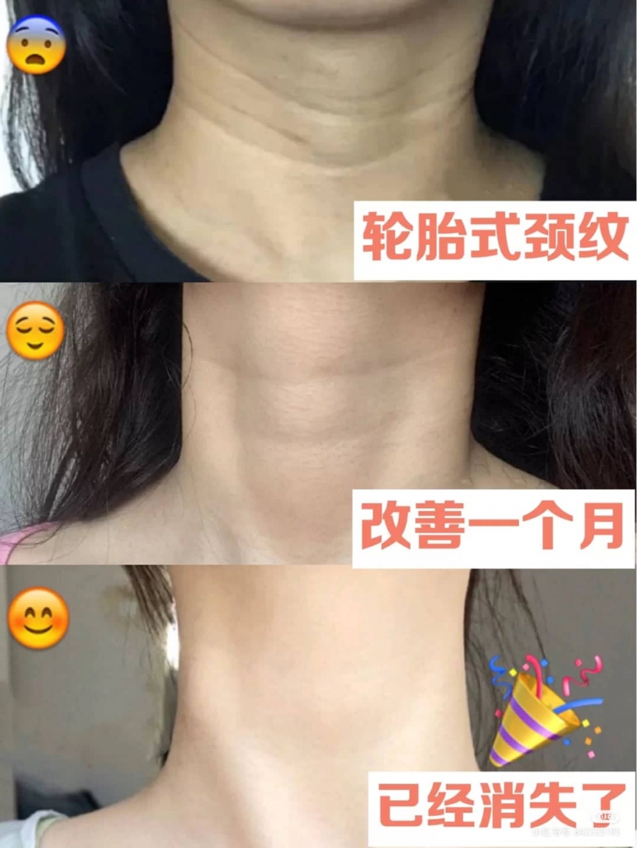 养出性感天鹅颈!