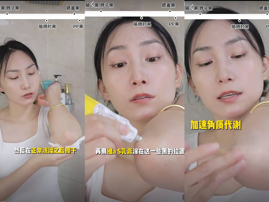 擦干之后再用维A酸乳膏