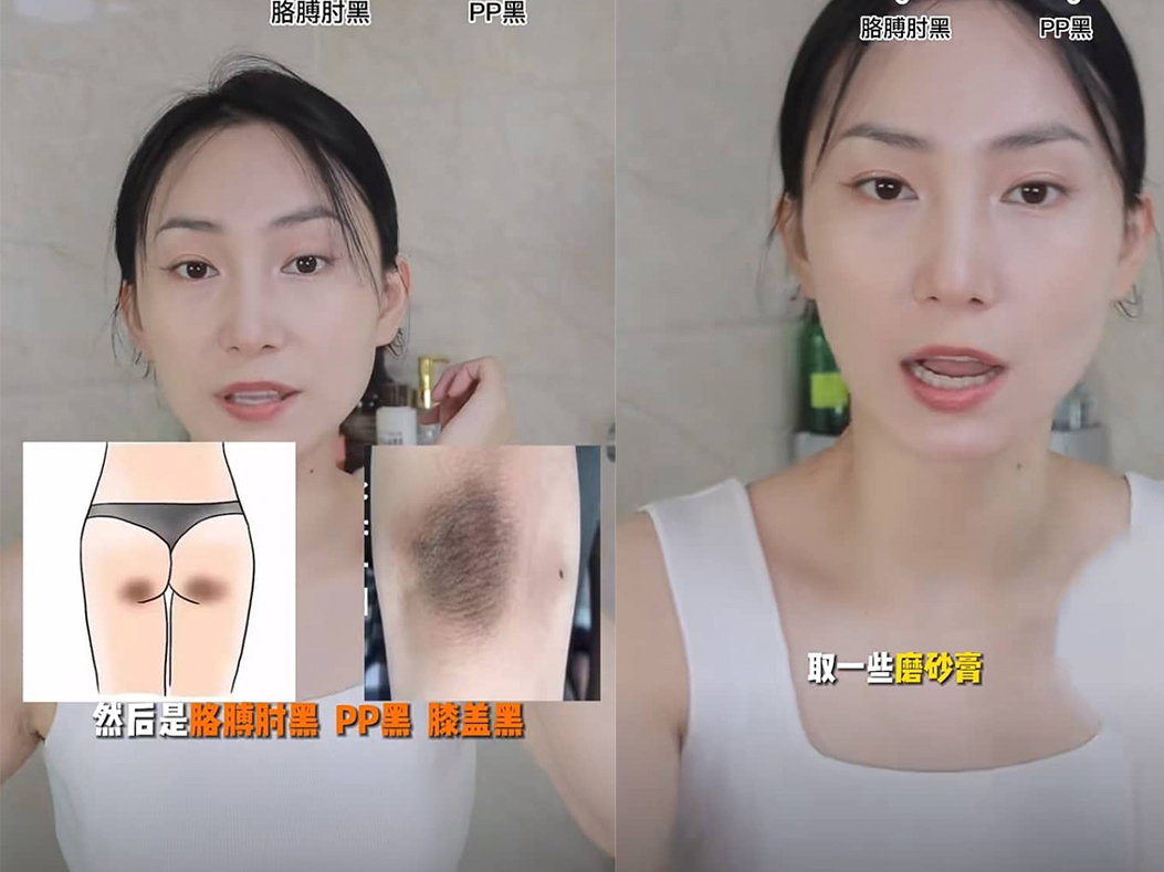 Step 2、胳膊肘黑