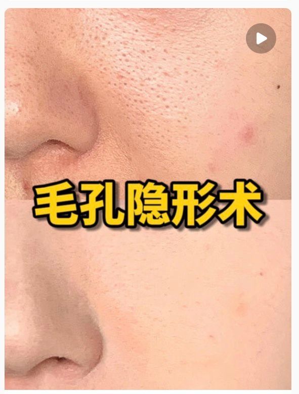 隐形毛孔管理